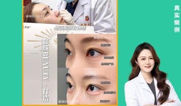 𝐃𝐫 ·高院长 如生熊猫眼周抗衰 专为眼周精细化抗衰定制