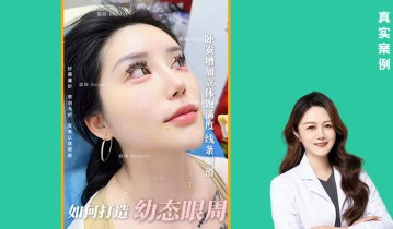𝐃𝐫 ·高璇院长 do个减龄卧蚕 👀打造幼态眼周案例