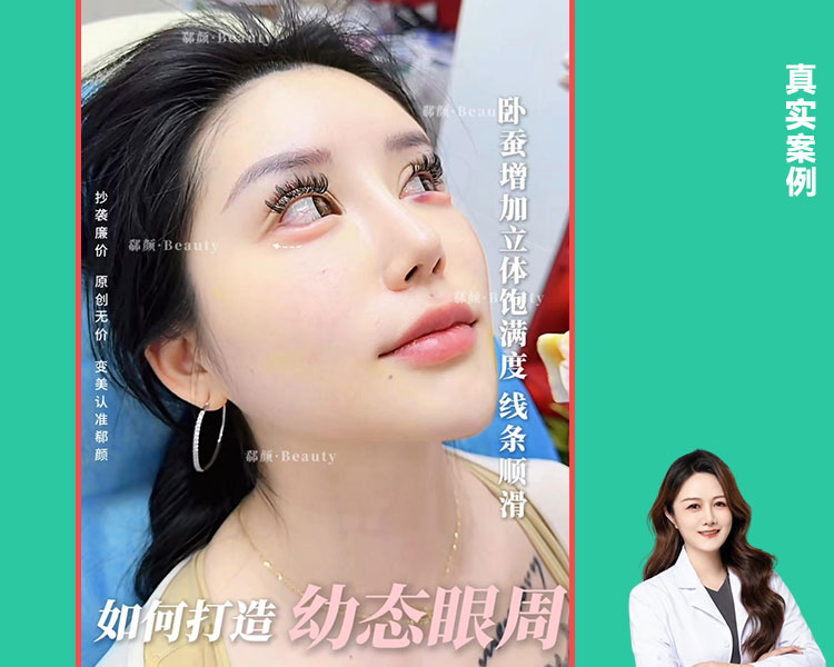 𝐃𝐫 ·高璇院长 do个减龄卧蚕 👀打造幼态眼周案例