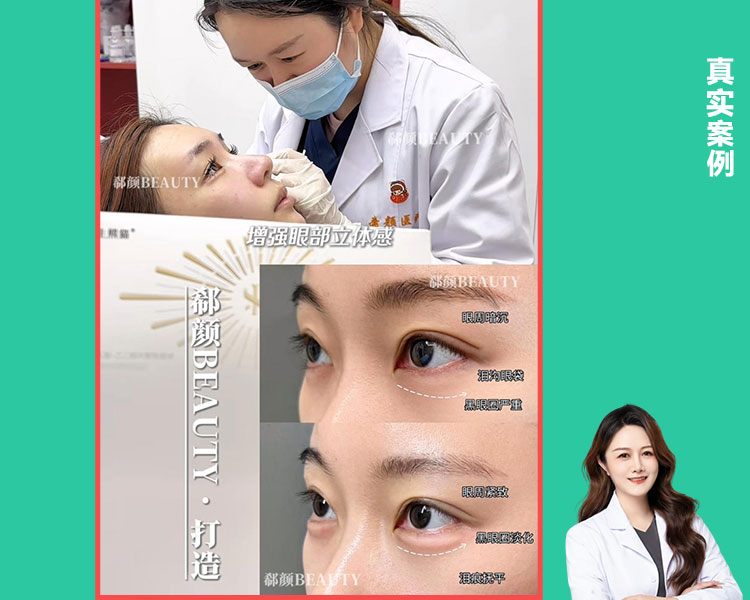 𝐃𝐫 ·高院长 如生熊猫眼周抗衰 专为眼周精细化抗衰定制
